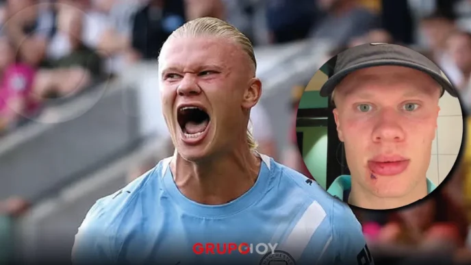 Erling Haaland accidente