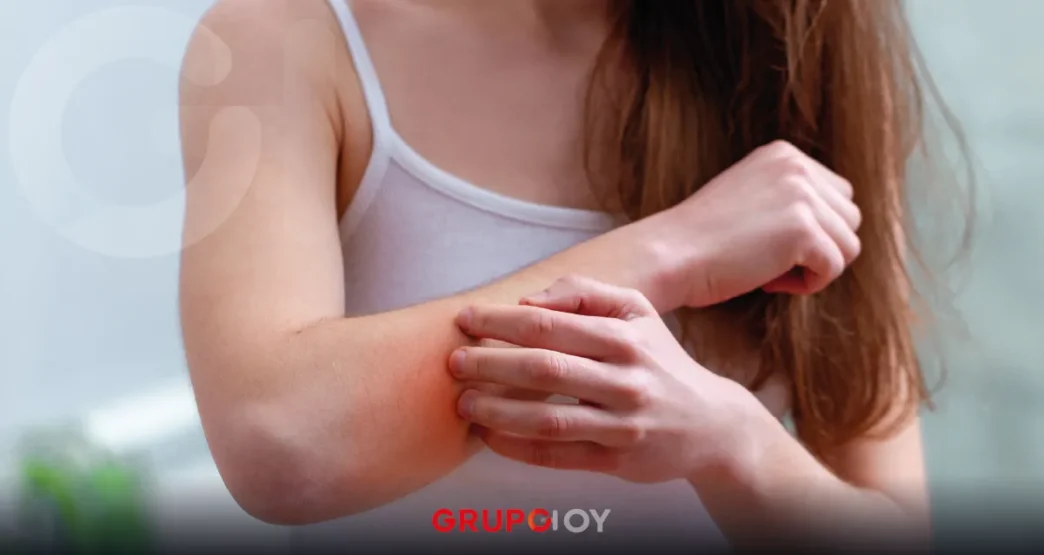 virus coxsackie en Hidalgo