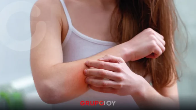 virus coxsackie en Hidalgo