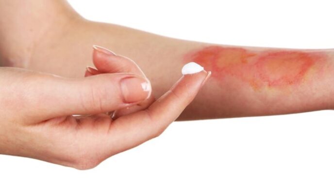 ¿Cuándo y dónde serán las jornadas quirúrgicas gratuitas para paladar hendido y quemaduras en Nuevo León?