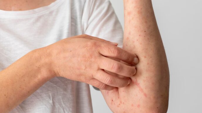 Sarampión en Puebla 2026: Confirmación del cuarto caso y avances del brote