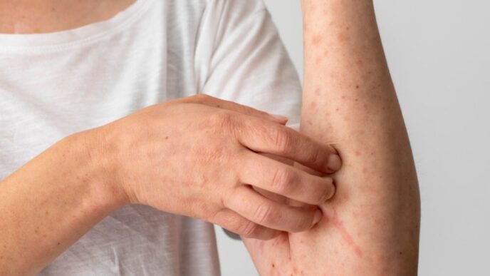 Sarampión en Tlaxcala: autoridades confirman 28 casos en enero y febrero de 2026