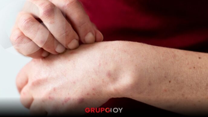 Sarampión en México: más de 8,000 casos confirmados y 27 fallecimientos